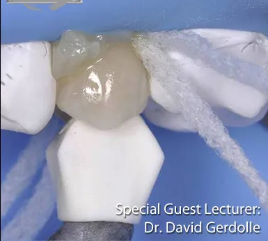 裁断済 Biomimetic Restorative Dentistry 81nsDp-2x0L._UF1000,1000_QL80_.jpg